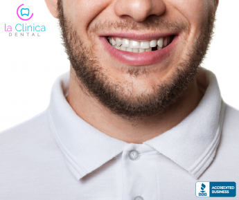 En La Clínica Dental estos son los principales motivos por los que se puede perder un diente en adultos 