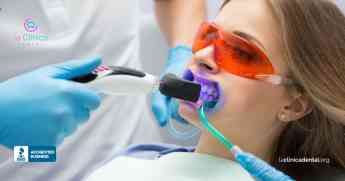 Blanqueamiento dental, que se debe saber antes de realizarlo por La Clínica Dental 