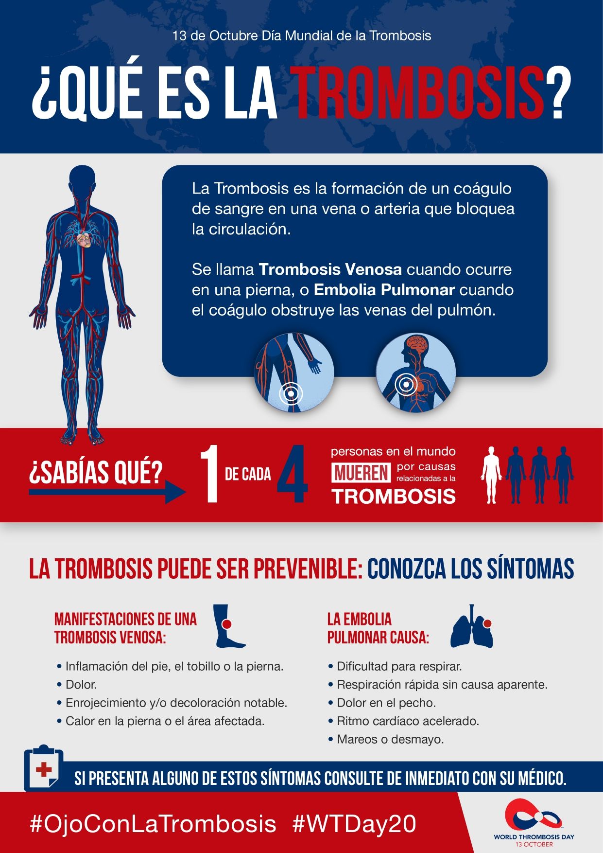Dia Mundial De La Trombosis La Prevencion Y La Deteccion Temprana Salvan Vidas