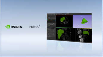 NVIDIA lanza el framework de imágenes MONAI y la Inception Alliance junto a GE Healthcare y Nuance