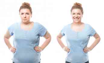 La cirugía bariátrica revierte el envejecimiento por la obesidad